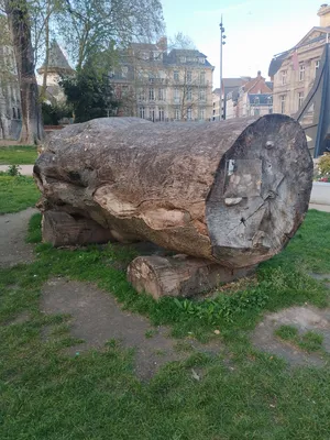 Gravure Fœtus et cordon ombilical à Rouen